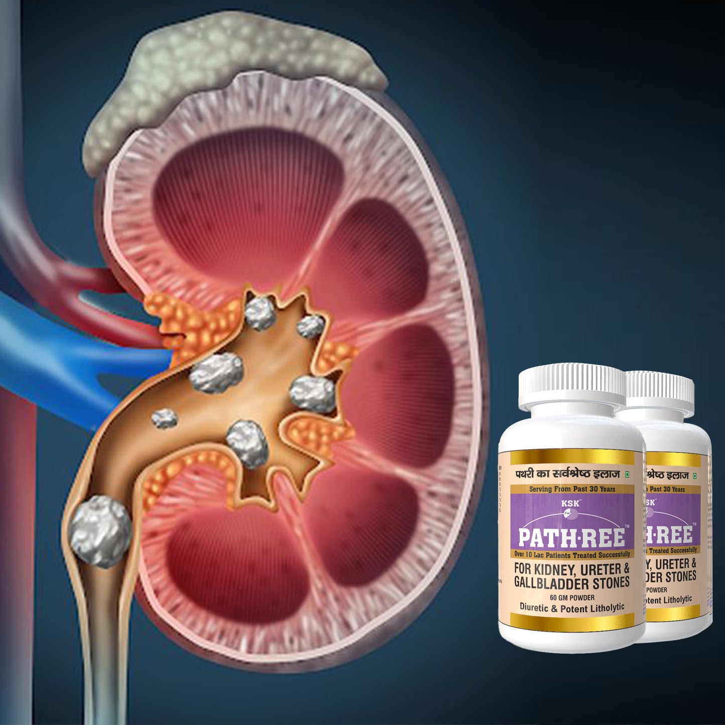 KSK PATH-REE™ Herbal Kit